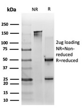 ZNF562 Antibody