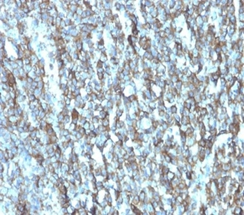 FBLIM1 Antibody