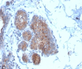 FBLIM1 Antibody