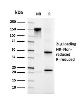 FBLIM1 Antibody