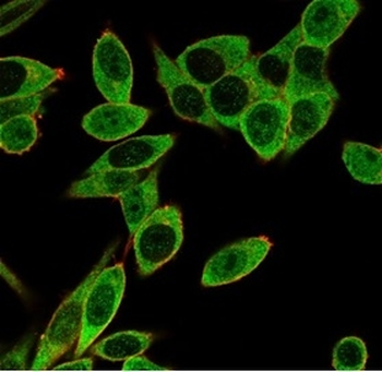 PMS1 Antibody