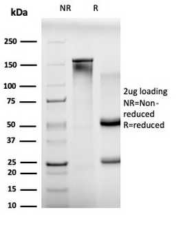 BCL11A Antibody