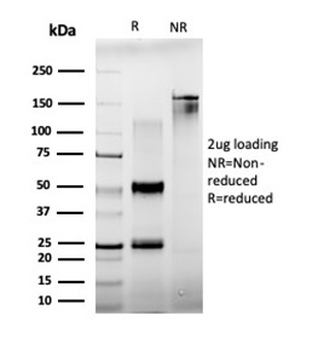 BCL11A Antibody