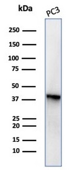 SERPINB5 Antibody