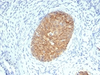 SERPINB5 Antibody