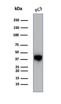 SERPINB5 Antibody