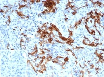 NGF-Receptor (p75) / CD271 (Soft Tissue Tumor Marker) Antibody