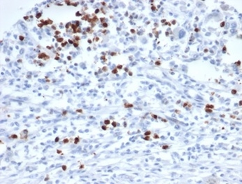 MEF2D Antibody