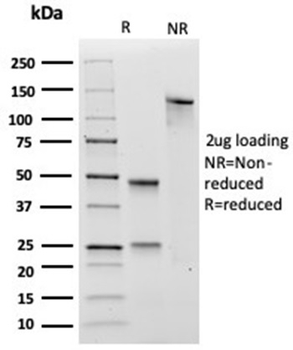 SOX4 Antibody