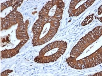 Cytokeratin, pan (Epithelial Marker) Antibody