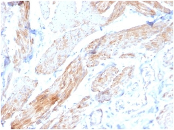 PGM5 Antibody
