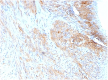 PGM5 Antibody