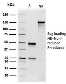 PGM5 Antibody