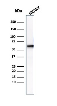 PGM5 Antibody