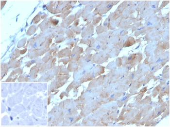NPPB Antibody