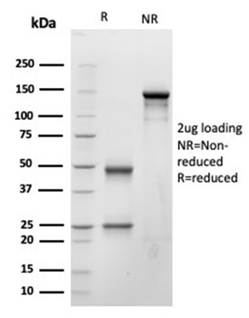 NPPB Antibody