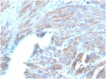 NPPB Antibody