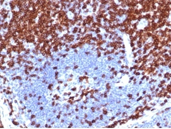 CD5 Antibody