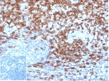 CD5 Antibody