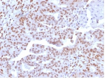 NEUROD2 Antibody