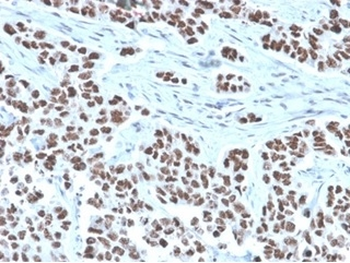 NEUROD2 Antibody