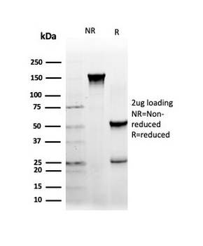 NEUROD2 Antibody