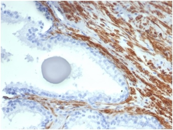 MYH11 Antibody