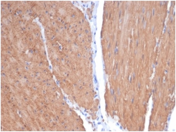 MYH11 Antibody