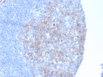 CD10 (Membrane Metalloendopeptidase) Antibody