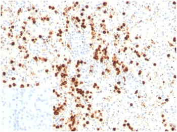 LYZ Antibody