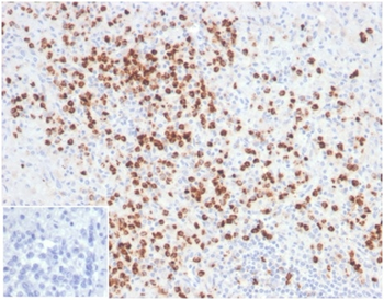 LYZ Antibody