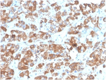 LHB Antibody