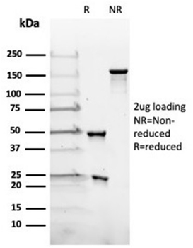 LHB Antibody