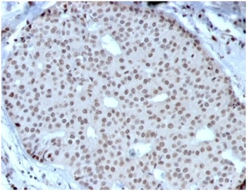 HOXB2 Antibody