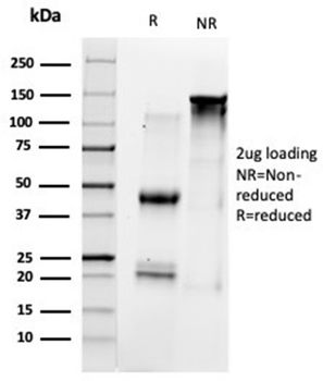 HDAC1 Antibody