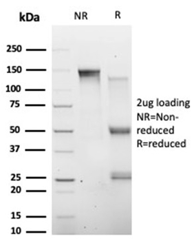 HIC2 Antibody