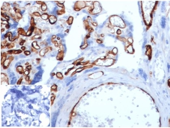 FABP4 Antibody
