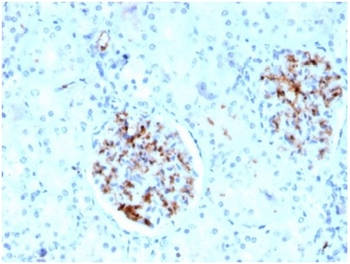 FABP4 Antibody