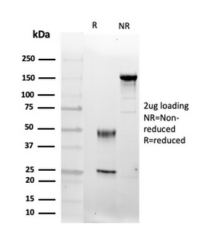 FGF23 Antibody
