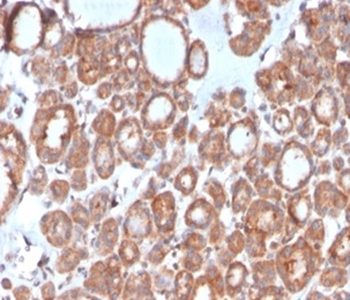 CALCA Antibody