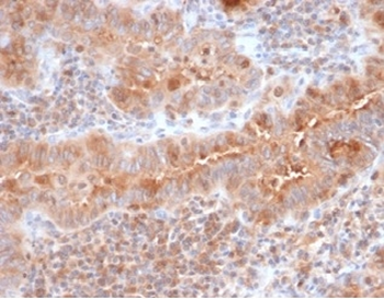 CALCA Antibody
