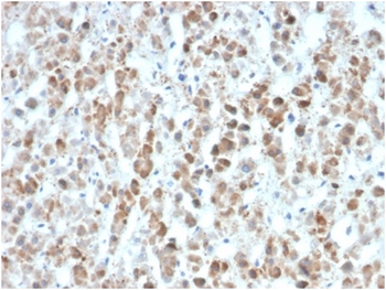 IL25 Antibody