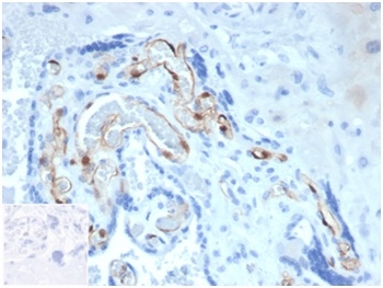 FABP4 Antibody
