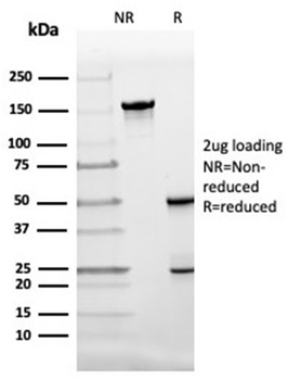 FABP4 Antibody