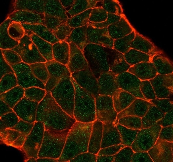 DCP2 Antibody