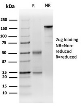 DCP2 Antibody