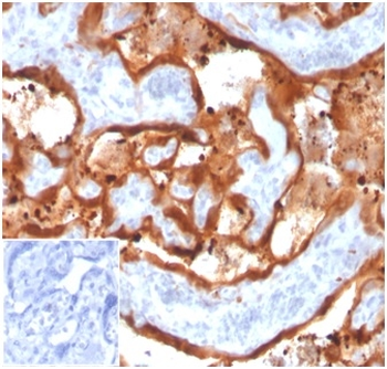 TGM2 Antibody