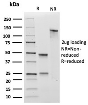 TGM2 Antibody