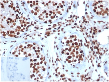 SMARCB1 Antibody