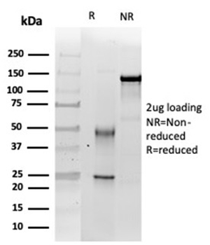 SMARCB1 Antibody